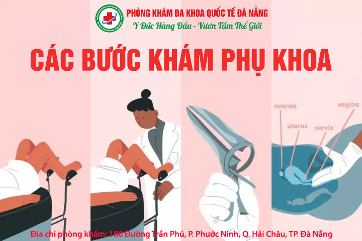 Các bước khám phụ khoa