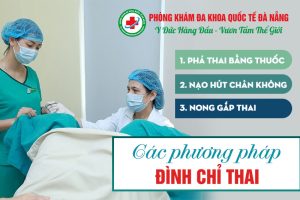 Các phương pháp phá thai an toàn
