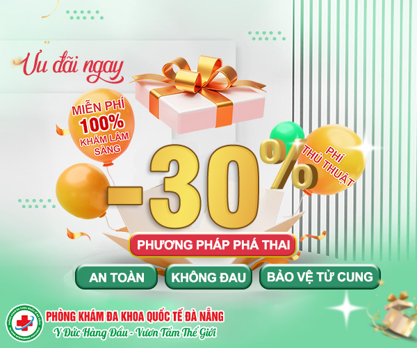 Chi phí công khai, minh bạch