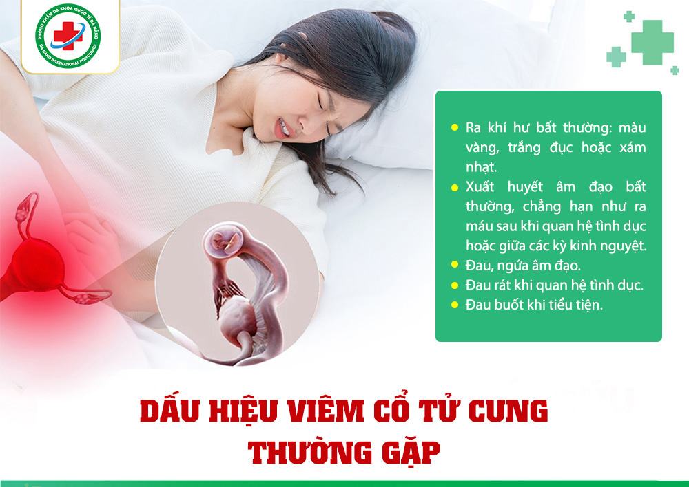 Dấu hiệu nhận biết viêm cổ tử cung