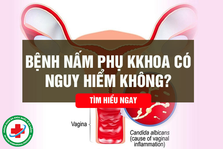Nấm phụ khoa có nguy hiểm không